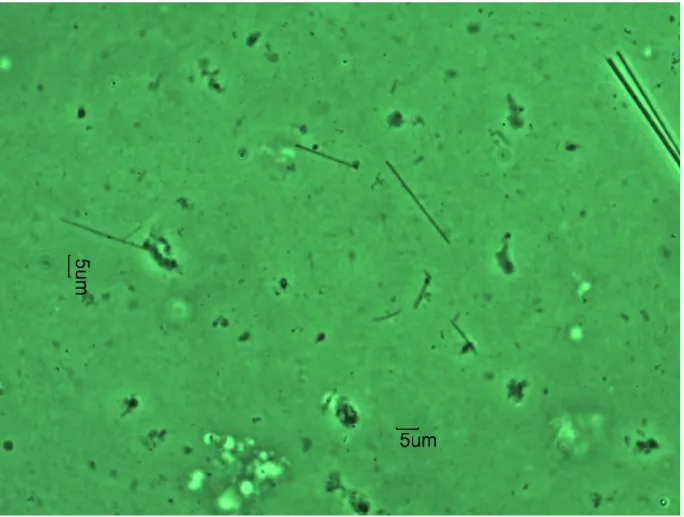 Figure  1.6.  Image  d’un  échantillon  contenant  des  fibres  d’amiante  amosite  sur  filtre,  prise par microscopie optique à contraste de phase 54 