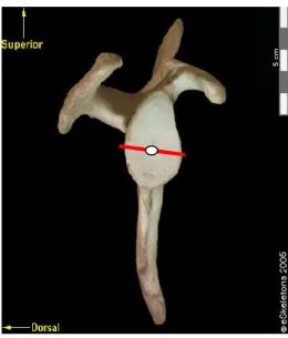 Figure 10: Angle antéro-postérieur de la  cavité glénoïde relativement à l’épine de la scapula
