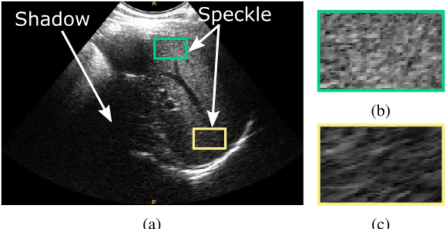 Fig. 2.5 Illustration of ultrasound shortcomings. (a) US image that represents partial view of the liver