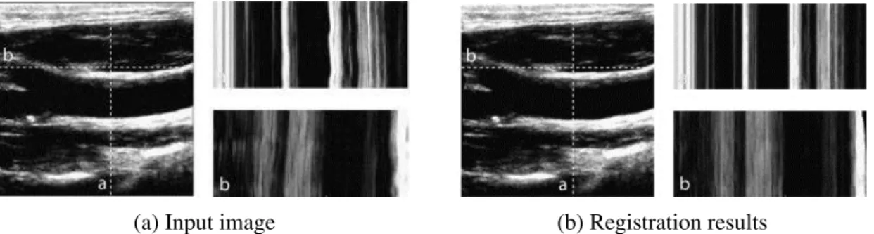 Fig. 3.3 Registration results obtained from group-wise registration method from Metz et al.