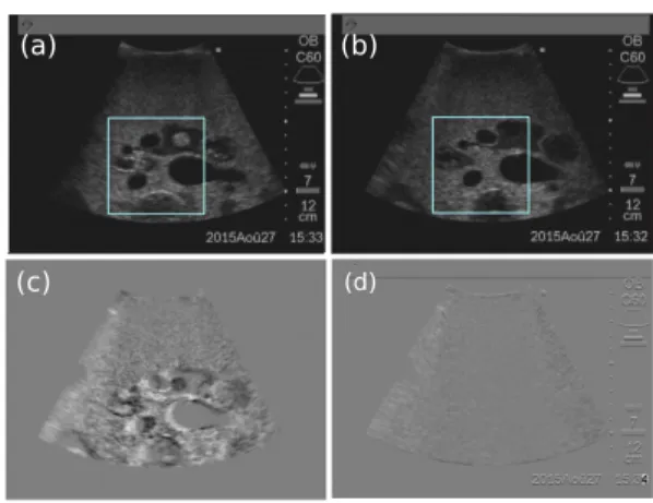 Fig. 8. Image sequence captured during a positioning task: (a) the initial image I(r 0 ), (b) the desired image I(r ∗ ), (c) the difference between the initial and the desired image and (d) the difference between the final and the desired images I di f f .