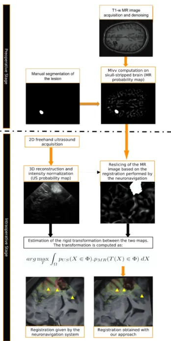 Figure 1: Illustration of the performed workflow to achieve the registration. The skull stripping, the denoising, the M Lvv computation and the segmentation of lesion are performed before the neurosurgical procedure