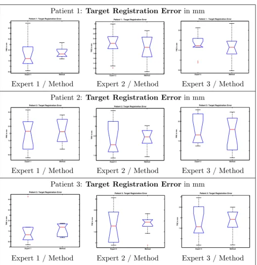 Table 3 shows the expert-based estimation of the a posteriori residual error of the different registrations (manual-based ˜T and automatic ˆT ) proposed for patient 2