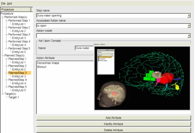 Figure 2: User interface for the planning software. Description of a surgical step and corresponding 3D  scene with relevant image entities