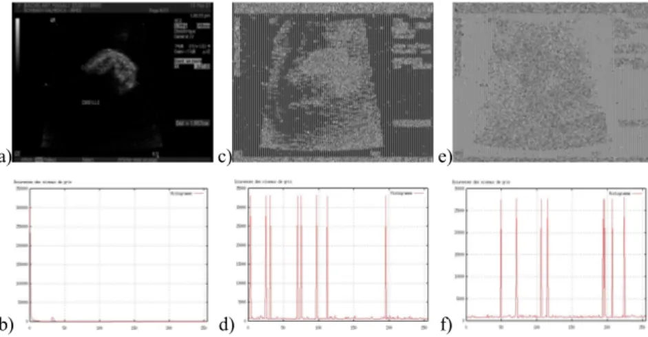 Figure 10.6. a) Medical ultrasound image (442KB), with large homogenous zones,   encrypted image; c) encrypted by DES algorithm (block of 8 pixels with a 64-bit key); 