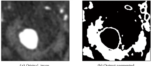 Figure  III.3  –  Result of segmentation with a LBM  anisotropic  diffusion reaction [Wan14]