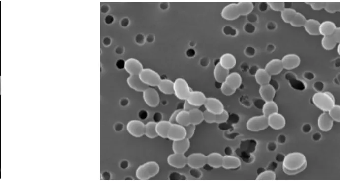 Figure 01:  Lactobacillus  et  Leuconostoc  observé au microscope électronique à transmission                                            (VIGNOLA 2002)