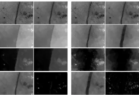 Fig. 5. Analysis of the retina in order to detect the micro-anevrysms and discard the vessel