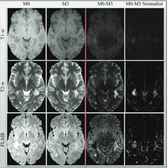 Figure 4 : (Gauche) Images sources de deux points temporels espacés de 3 mois (M0 et M3)