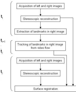 Figure 2: Clinical setting: a stereovision system (in RED, cameras and cables) was set up between the NC4 surgical microscope and the binocular tube.
