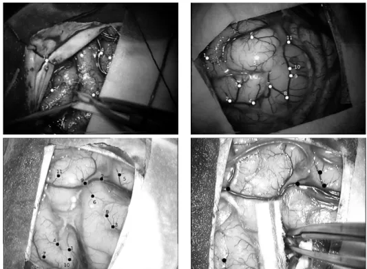 Figure 4: Performance evaluation of our video tracking method: from top to bottom and from left to right: Video sequences 1-4 with marked points corresponding to points to track