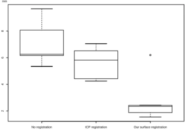 Figure 10: Results: The source surface was the reconstructed sur- face before resection, the target surface was the reconstructed  sur-face after resection