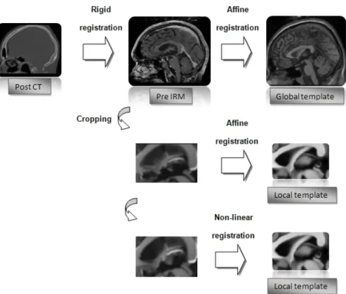 Fig 2: Registration Workflow between post-operative CT and the MR template