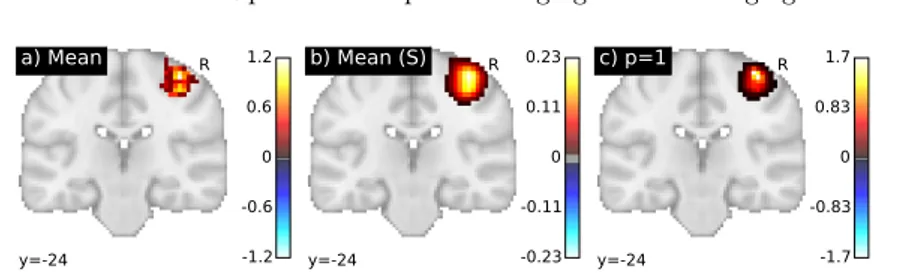Fig. 2. Averaging of the standardized effect of interest on fMRI data. From left to right, a) the Euclidian mean without smoothing, b) the Euclidian mean with smoothing (FWHM=8 mm), c) the Kantorovich mean with Euclidian ground metric and p=1.