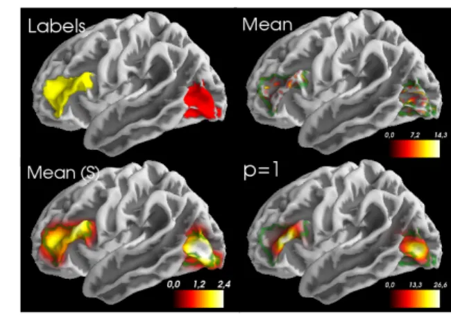 Fig. 1. Simulation results with focal random signals generated in areas/labels BA45 (yellow) and MT (red) in a group of 100 subjects