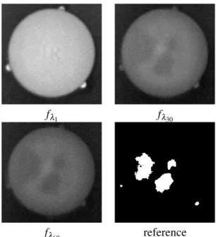 Fig. 1. Three channels of the original image and the reference obtained by Legrand et al