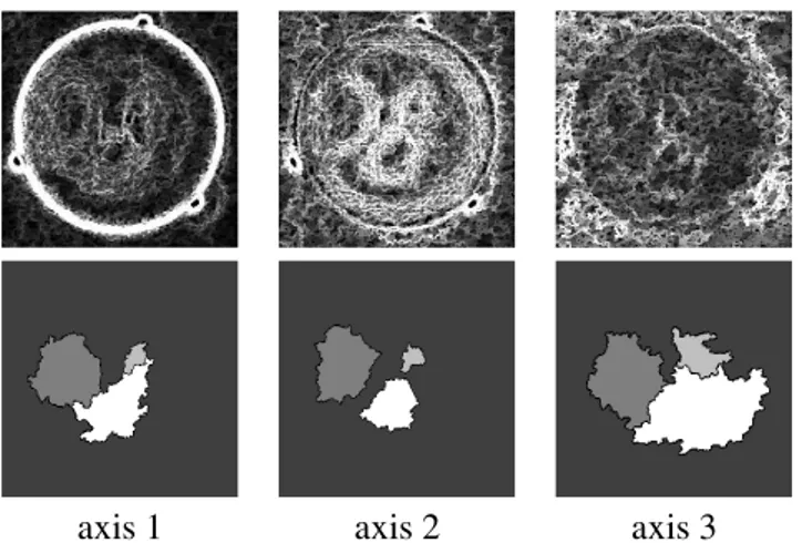 Fig. 12. Segmentations on PCA parameters factors on the 3 axes: (a) Euclidean gradient, (b) associated watershed, (c) gradient supremum, (d) associated watershed, (e) weighted sum gradient, (f) associated watershed