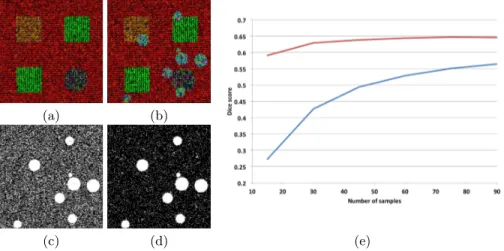 Fig. 1. Quantitative Detection Power on Simulated Data. Left: Illustration of one noisy reference database image (a) and the simulated lesions image (b), as well as results of detection utilizing 15 images from the database with M 1 (c) and M 2 (d).