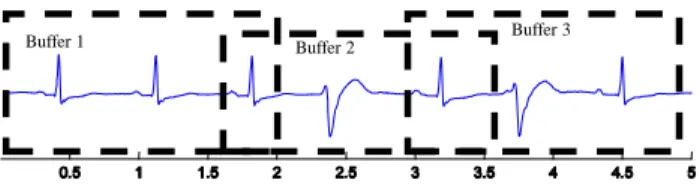 Fig. 2. Méthode de buffering avec recouvrement partiel  dans le système de monitoring cardiaque IP-Calicot