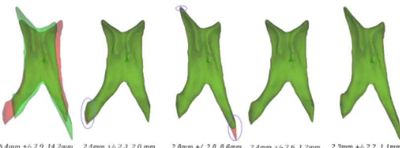 Fig. 2. Registration of lateral ventricles. From left to right: (i) two misaligned pairs of lateral ventricles A and B (from Exp