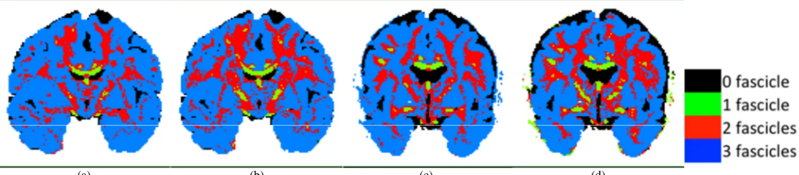 Fig. 1 shows coronal slices of the map of optimal number of fascicles obtained by generalization error (a,c) and by model averaging (b,d)