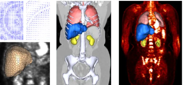 Figure 2: Top-left: Axial slice of GVF computed on a CT image (left) and detail (right)