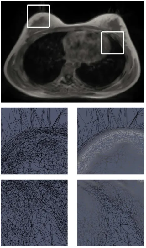 Figure 10. Adapted mesh for subject 15. Top image shows an axial slice through the adapted mesh with grey level interpolation