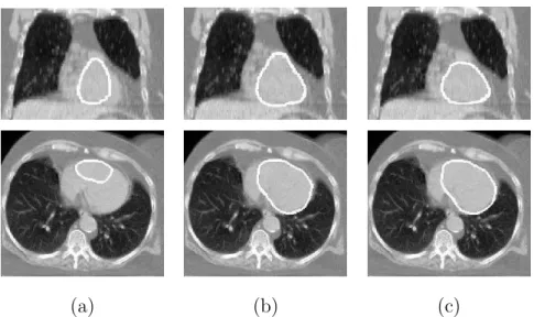 Fig. 9. Coronal (top row) and axial (bottom row) views of some results of heart segmentation