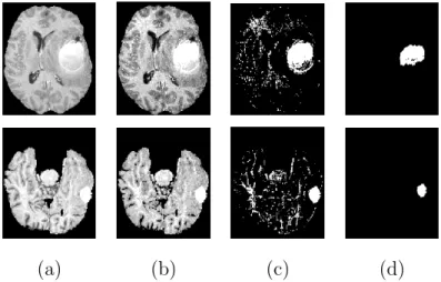 Fig. 4. Results obtained in the classification step for two 3D images. (a) One axial slice of the segmented brain