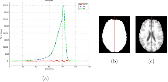 Fig. 5. (a) Graph of H s , H n and H p for a normal image (image (c)) (for visualization purposes H s is multiplied by 2)