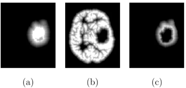 Fig. 11. Spatial relations used for segmenting the tumor detected in Figure 8 (highest gray level values correspond to regions where the spatial relation is best satisfied).