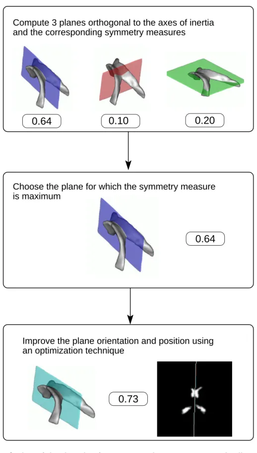 Fig. 4. Outline of the algorithm for symmetry plane computation. The illustration is a fuzzy segmentation of lateral ventricles in a 3D MR image of the brain