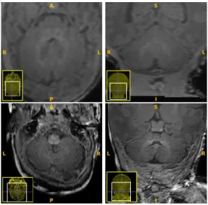 Fig. 1. Examples of MR images (left: axial view; right: coronal view). First row: