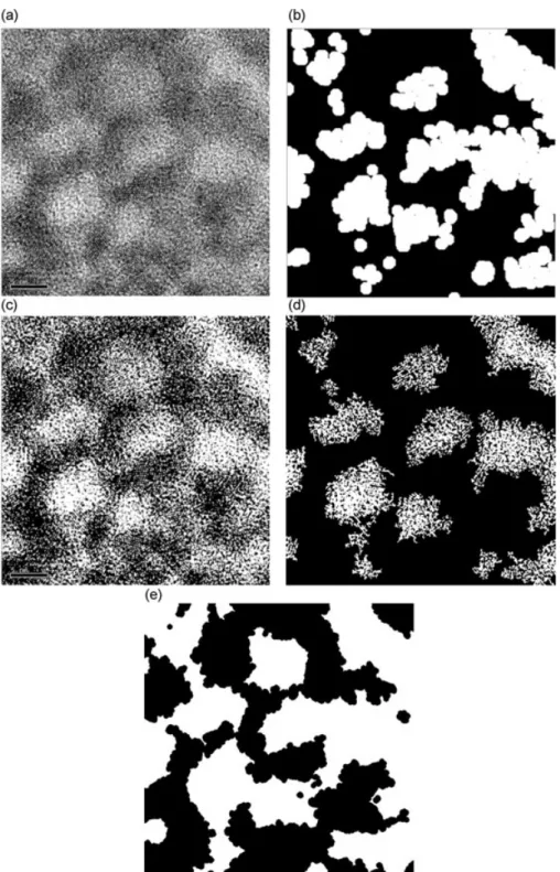 Fig. 2. The various steps to obtain the binary image of pores I p (example on an image of set 1)
