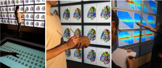 Figure 3: Interaction instruments. (left) An interaction instrument sorts the 64 displayed  brain  scans,  (center)  a  brain  prop  controls  the  scan  orientation,  and  (right)  a  digital  pen annotates content on the wall