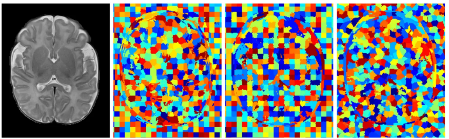 Figure 2: From left to right: input image; SLIC superpixel partitioning; classical watervoxel parti- parti-tioning; and watervoxel partitioning with the m-marker recomputed distance map