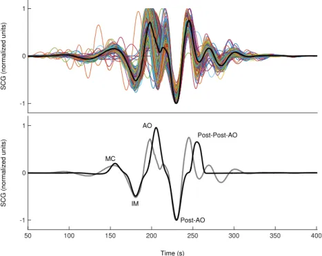Figure 5: Top Seismocardiogram within 200 ms of all identified profile peaks (n = 349) of a single participant, centered around their minimums