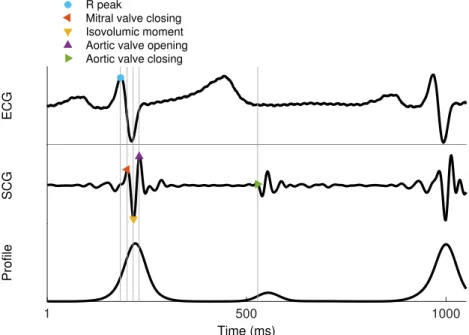 Figure 1: Example electrocardiogram (ECG), seismocardiogram (SCG), and SCG profile with relevant fiducial points