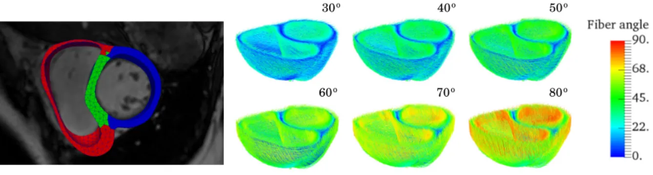 FIGURE 1 Left: finite element mesh of a biventricular geometry reconstructed from MR images separated into 3 material regions, namely, LVFW (blue), septum (green) and RVFW (right)