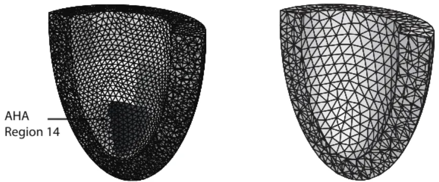 Figure 3: Reference mesh with ‘infarcted’ region (left) - ‘Desired’ mesh to be used in estimation (right)