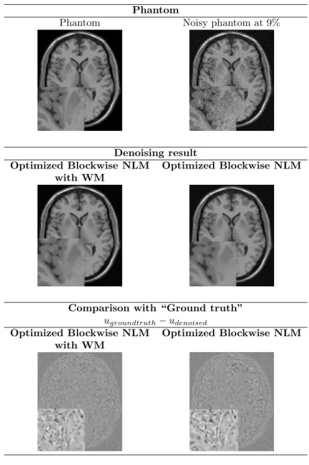 Figure 7: Top: Phantom and Phantom noisy with 9%. Middle: the denoising result obtained with the Optimized Blockwise NLM with WM filter and the Optimized Blockwise NLM filter