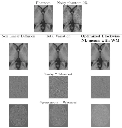 Figure 10: Comparison with Non Linear Diffusion, Total Variation and our Optimized blockwise NL-means with wavelet mixing denoising on synthetic T1-w images