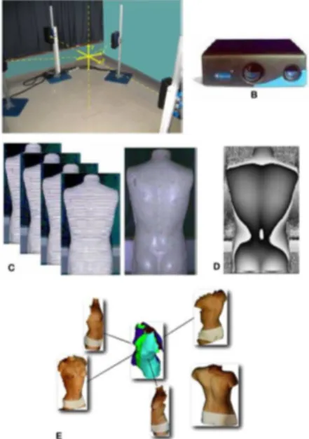 Figure 4.2 Trunk topography measurement and reconstruction. (A) Experimental set-up at Sainte-Justine Hospital of four Creaform optical digitizers