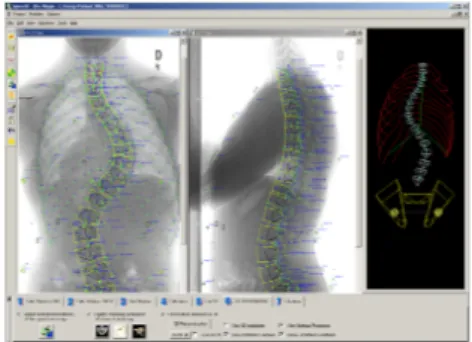 Figure 4.3 Graphical user interface of the system for 3D reconstruction of the bone structures.