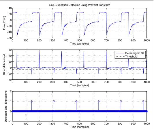 Figure 5 End-Expiration Detection using Wavelet transform. This figure illustrates the detection of end-expirations based on respiratory flow signal: (top) respiratory flow curve obtained from a patient, (middle) signal in the level-2 detail band of the wa