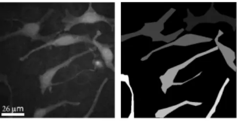 Figure 6: Foreground and brackground gray distributions on a multiphoton image of engineered skin containing keratinocytes and melanocytes.