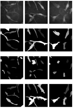 Figure 11: Segmentation of melanocytes using area-stable elongation. First row: input image; second row: ground truth; third row: MSER; fourth row: