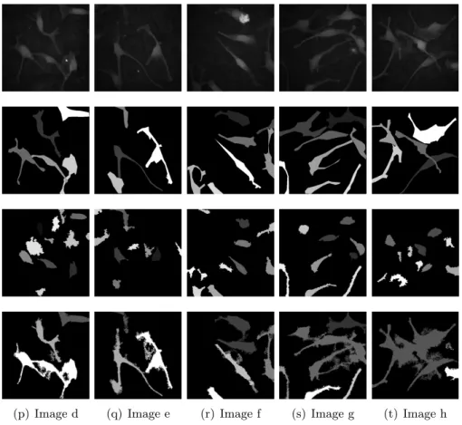 Figure 12: Segmentation of melanocytes using area-stable elongation. First row: input image; second row: ground truth; third row: MSER; fourth row:
