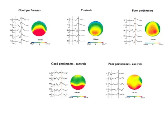 Fig. 3. Top: waveforms for five electrodes (Fz, Cz, Oz, T5, T6) next to topographical maps cf the mean voltage amplitudes (tV — see middle colorbar) in good performers (left), controls (middle), and poor performers (right) groups, at the maximum amplitude 