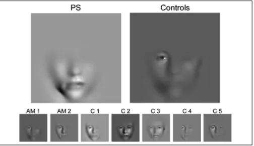 Figure 2. Comparaison des régions efficacement utilisées pour reconnaître l’identité d’un visage familier  chez une participante prosopagnosique (PS) et chez les sujets contrôles